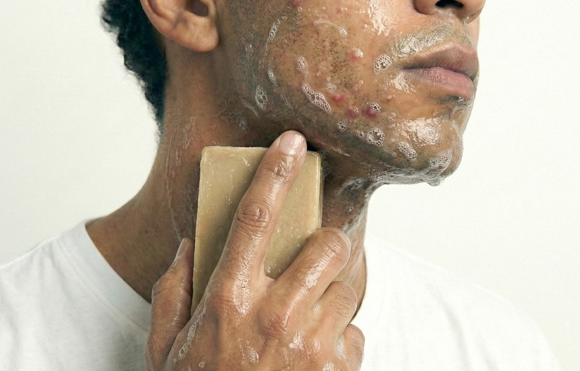 Étape 1 : Nettoyer la Zone avec un Savon Purifiant