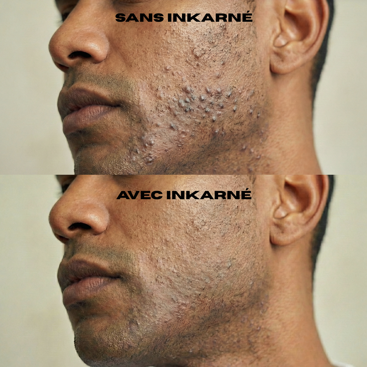 avant après incarné