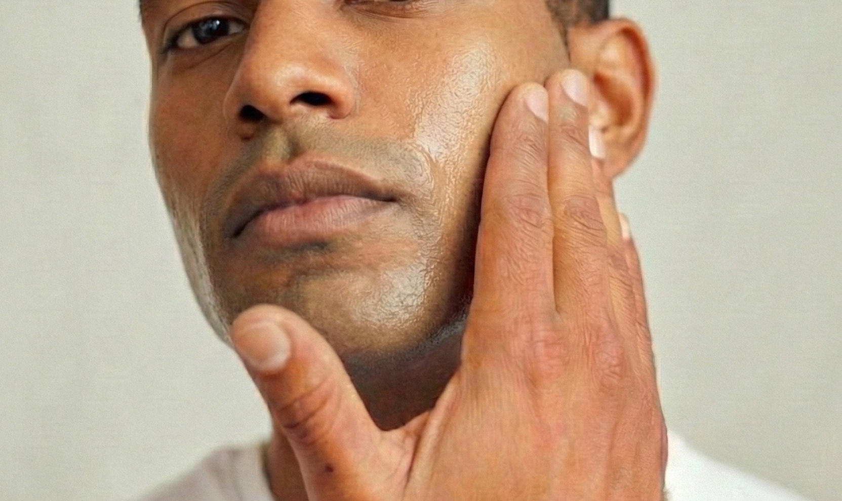 poils incarnés barbe